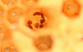 Varroa